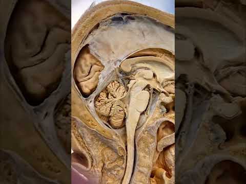 Youtube orgasmo-eléctrico: Esto es lo que conecta ambos lados de tu cerebro.. #shorts